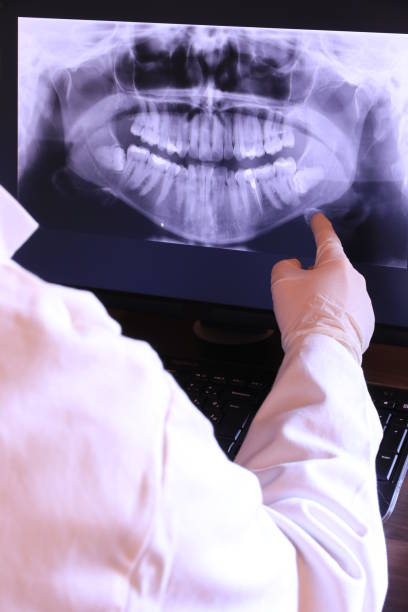 Best Emergency Dentist for Knocked-Out Tooth in Phenix City, AL