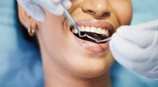 Best Emergency Dental Care for Abscessed Tooth in Phenix City, AL